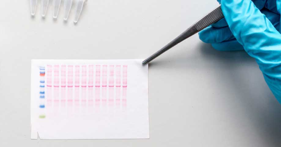 2020-01-Western-blot.jpg